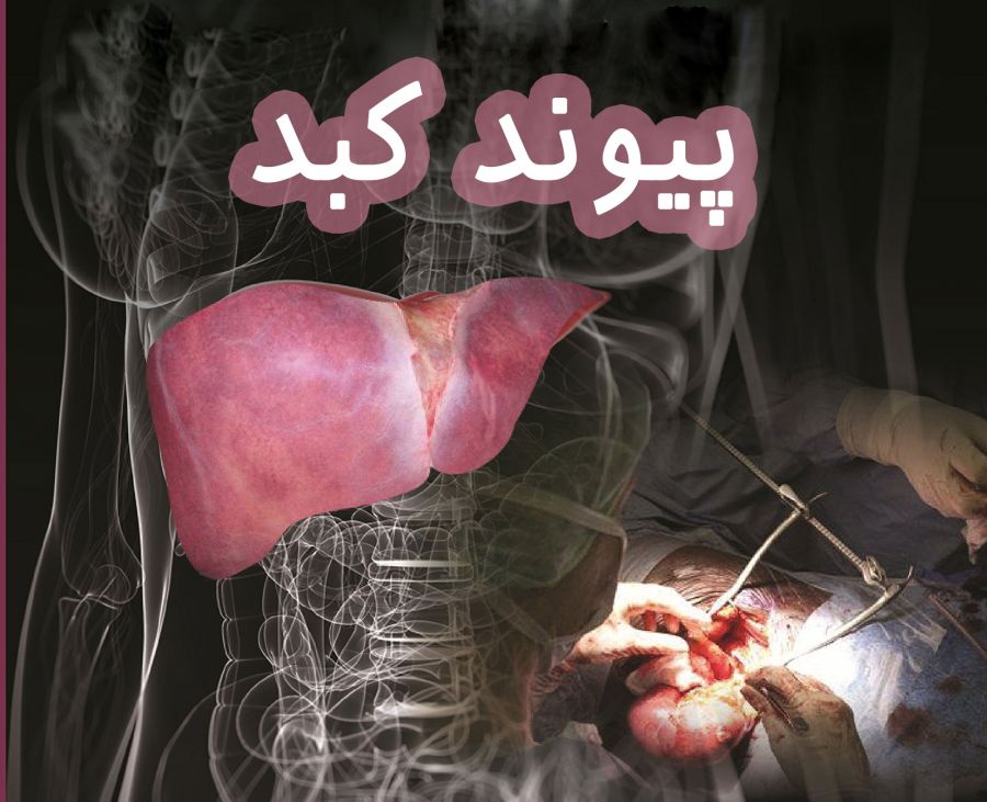 liver transplant