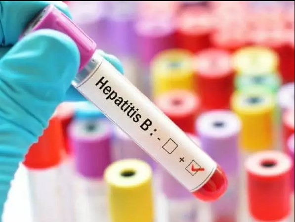 HBV-test